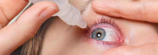Dry Eye: causes, symptoms and available solutions
