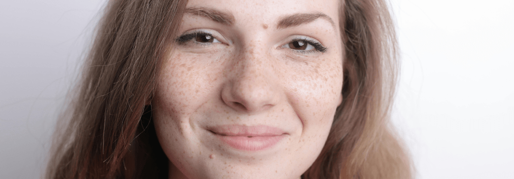 Fading Away: A Skincare Routine for Dark Spots and Melasma - Healtsy