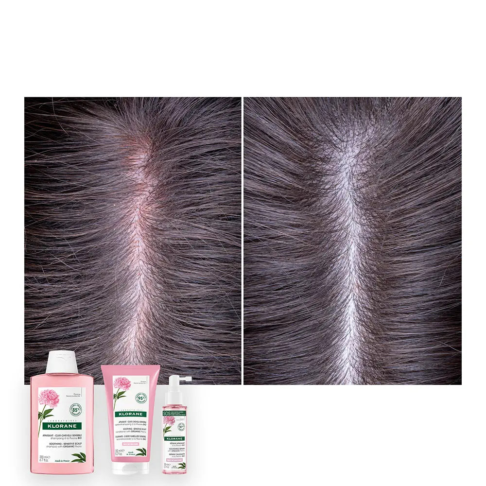 Klorane Kapillarserum SOS Pfingstrose – 100 ml