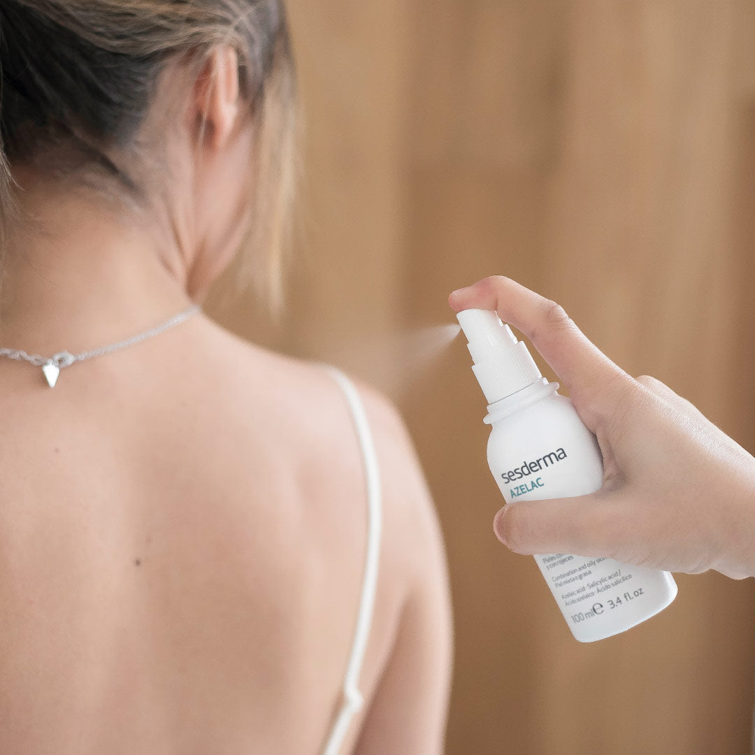 Sesderma Azelac Body Lotion - 100ml - Healtsy