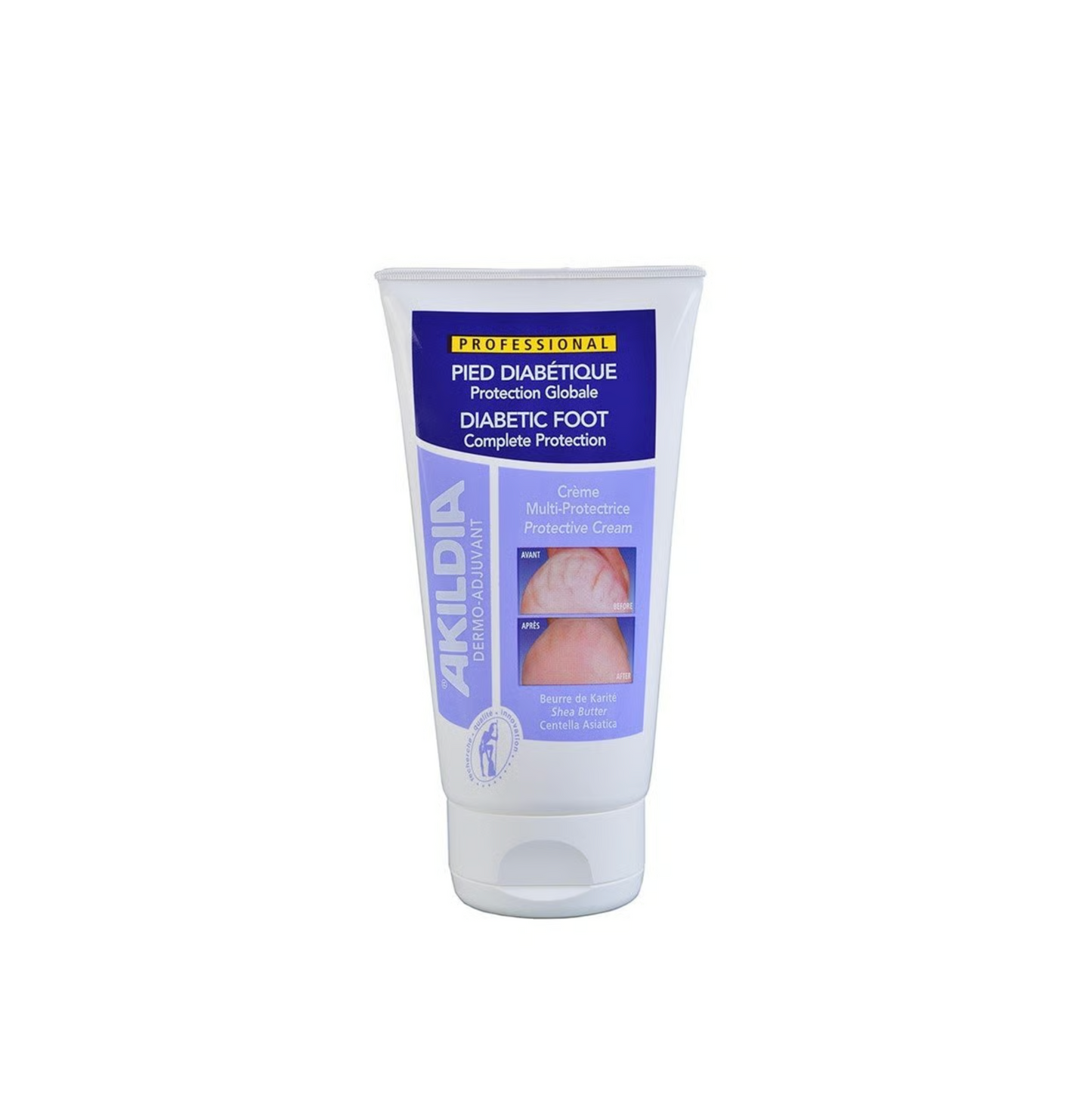 Akildia Diabetic Foot Cream - 150ml