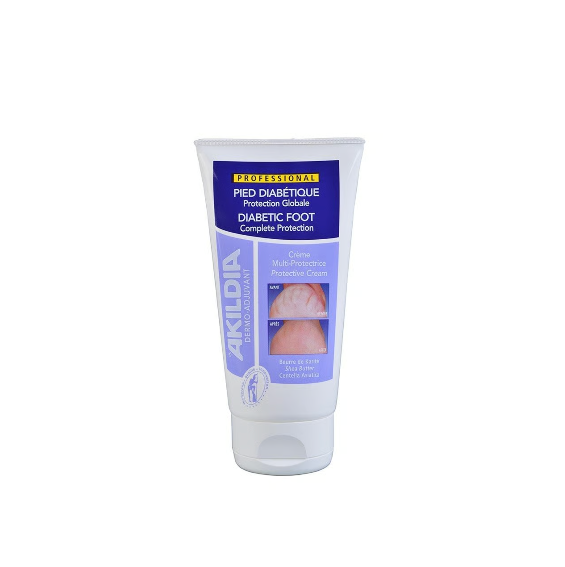 Akildia Diabetic Foot Cream - 150ml - Healtsy