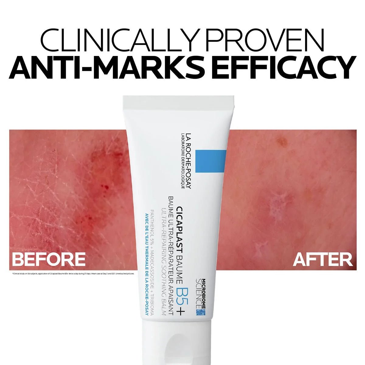 La Roche - Posay Cicaplast B5+ Ultra Repair - 100ml – Buy Now at Healtsy