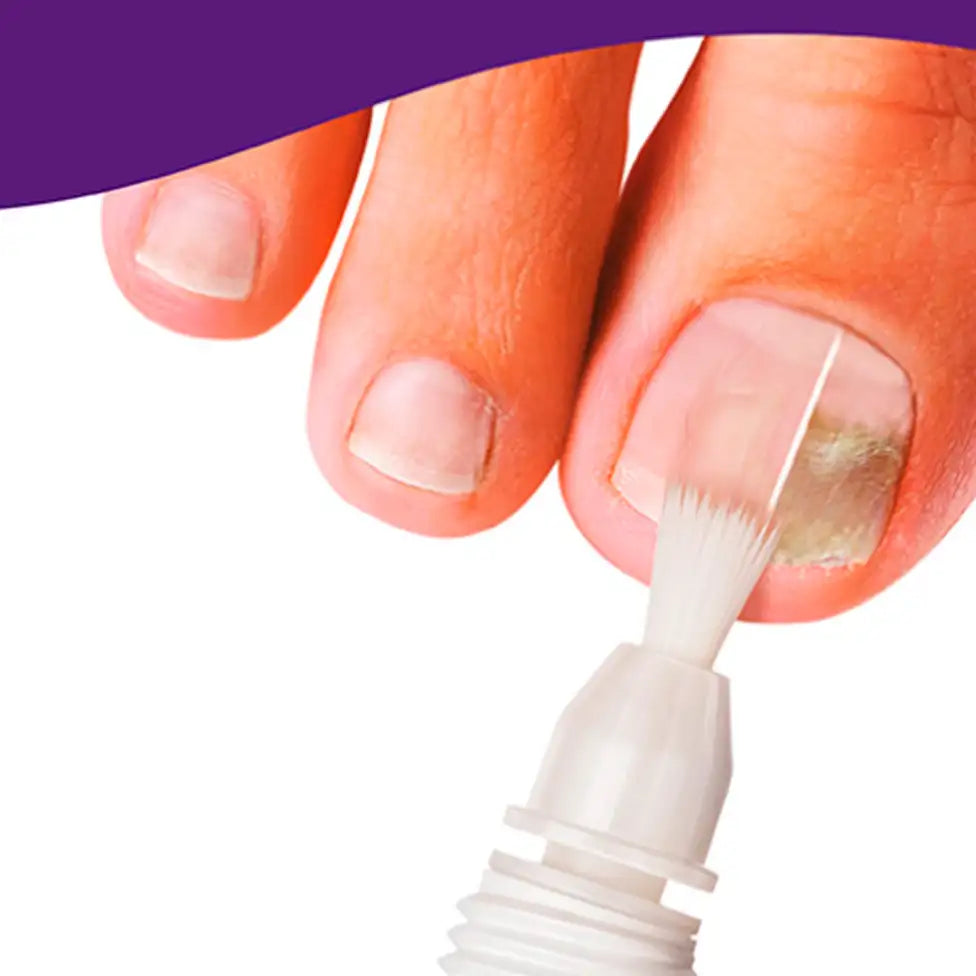 Mycosana Nails Solution - 5ml + 10 limes - Healtsy